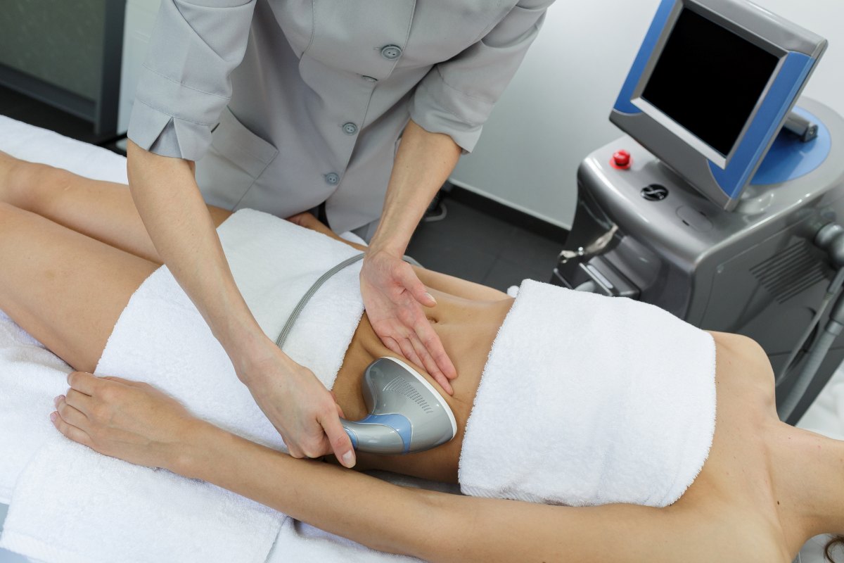 Body contouring procedure