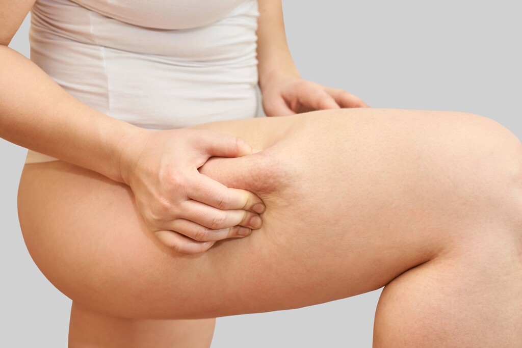 Female pinching her thigh fat