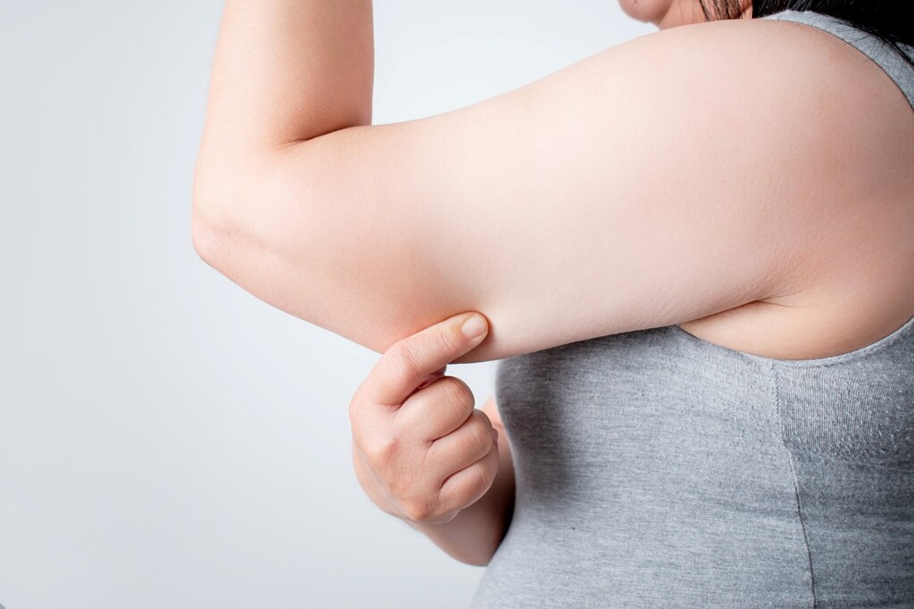 woman with fat and saggy arm